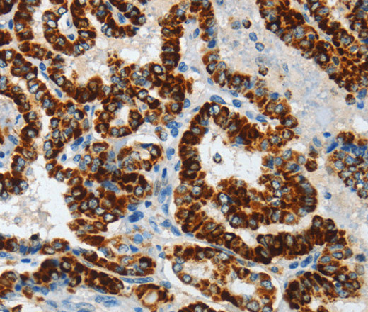 ASB4 Polyclonal Antibody (E-AB-14749)