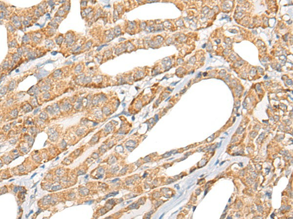 CCL5 Polyclonal Antibody (E-AB-17864)