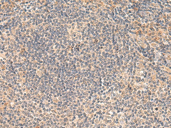 FUNDC2 Polyclonal Antibody (E-AB-18928)