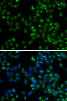 DUSP22 Polyclonal Antibody (E-AB-61616)