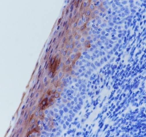 Recombinant Keratin 4 Monoclonal Antibody (AN301579L)