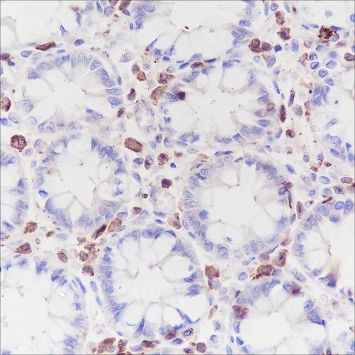 Recombinant CSF-1R Monoclonal Antibody (AN301500L)