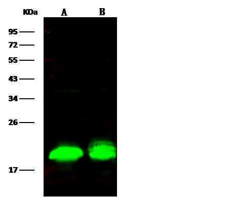Recombinant 4E-BP1/EIF4EBP1 Monoclonal Antibody (AN300048P)