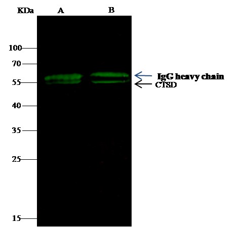 Recombinant Cathepsin D/CTSD Monoclonal Antibody (AN300479P)