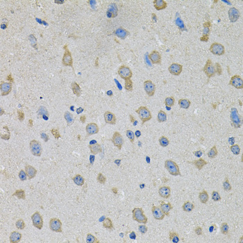 PTK7 Polyclonal Antibody (E-AB-62885)