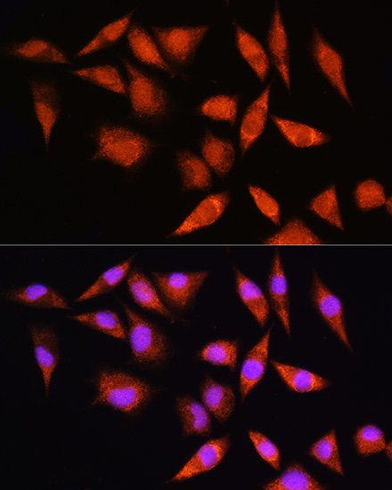 HSPA2 Polyclonal Antibody (E-AB-62788)