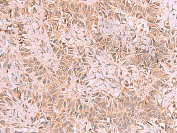 RRP8 Polyclonal Antibody (E-AB-52961)