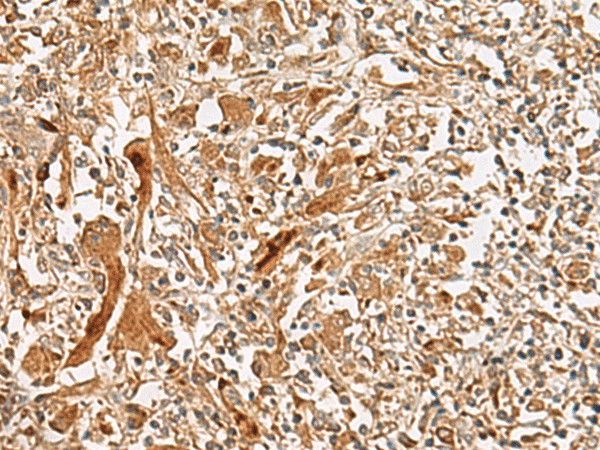 GCC2 Polyclonal Antibody (E-AB-17992)