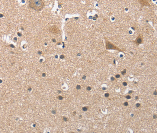 BUB1 Polyclonal Antibody (E-AB-11014)