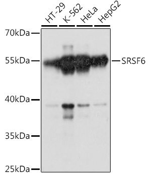SRSF6 Polyclonal Antibody (E-AB-90902)