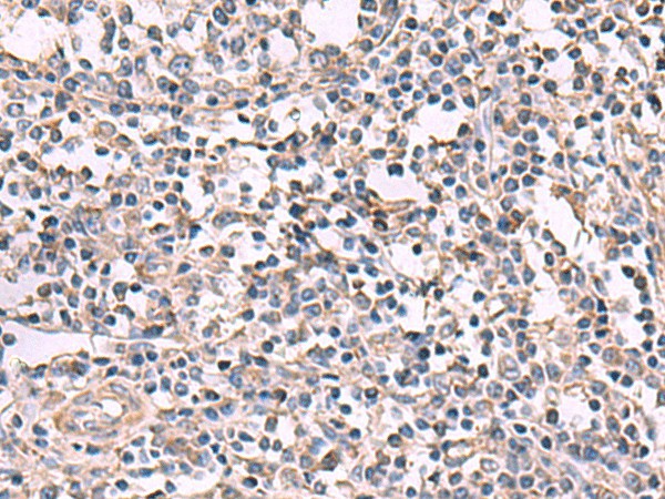 KCNK18 Polyclonal Antibody (E-AB-52079)