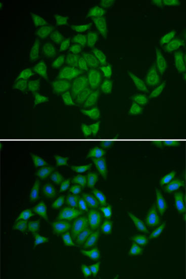 AMPD3 Polyclonal Antibody (E-AB-66080)