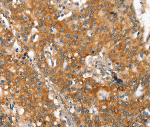MMP2 Polyclonal Antibody (E-AB-13064)