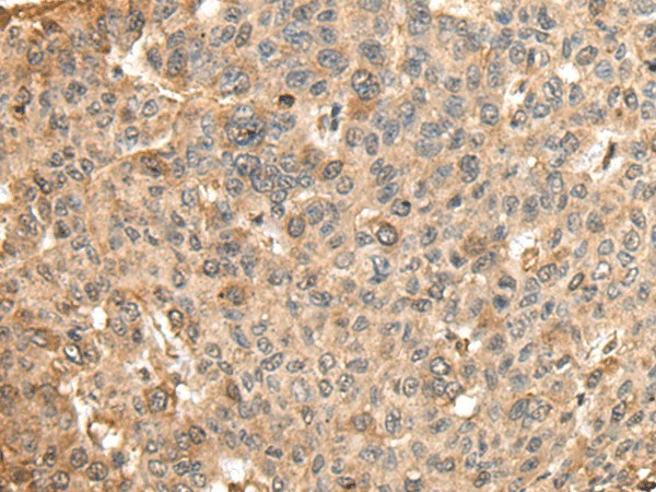 HMMR Polyclonal Antibody (E-AB-18591)