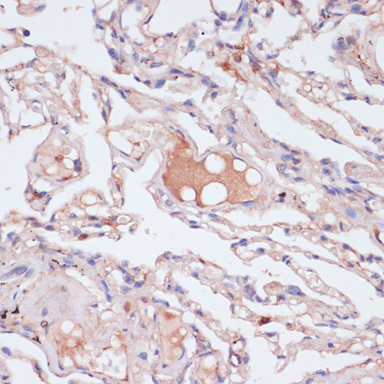 IFNG Polyclonal Antibody (E-AB-65910)