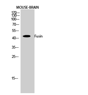 CXCR4 Polyclonal Antibody (E-AB-31485)