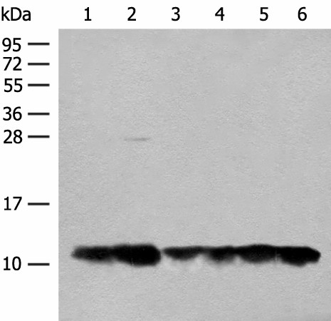 ATP5L Polyclonal Antibody (E-AB-52677)