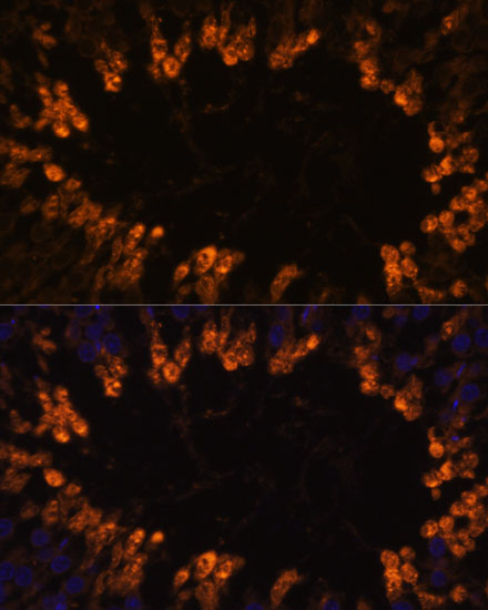 OXCT2 Polyclonal Antibody (E-AB-66370)