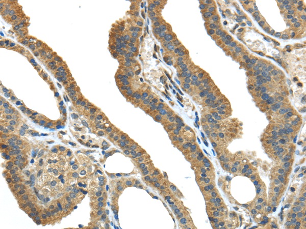 TMPRSS13 Polyclonal Antibody (E-AB-17115)