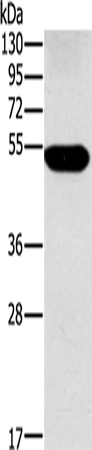 FUCA1 Polyclonal Antibody (E-AB-15050)