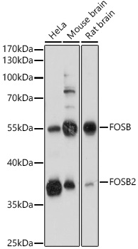 FOSB Polyclonal Antibody (E-AB-90928)