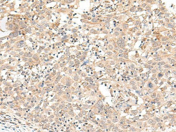 FUT3 Polyclonal Antibody (E-AB-17979)