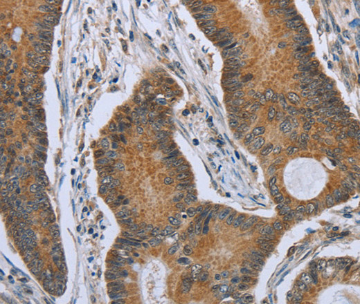 TNFRSF13C Polyclonal Antibody (E-AB-16646)