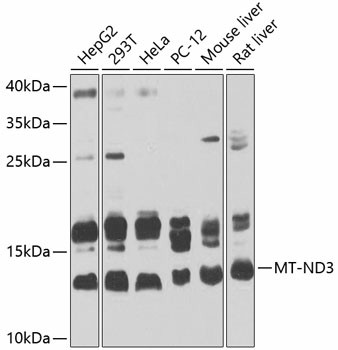 MT-ND3 Polyclonal Antibody (E-AB-93405)