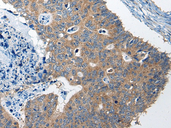 RTN4IP1 Polyclonal Antibody (E-AB-17812)