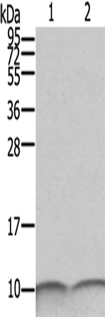 S100A6 Polyclonal Antibody (E-AB-11563)