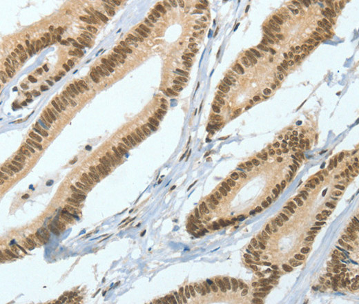 ASH2L Polyclonal Antibody (E-AB-14753)