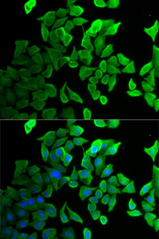 SEPT2 Polyclonal Antibody (E-AB-61123)