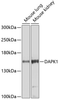 DAPK1 Polyclonal Antibody (E-AB-61095)