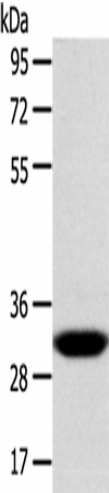 CCS Polyclonal Antibody (E-AB-16871)
