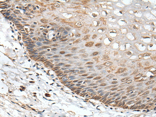 CHRNA5 Polyclonal Antibody (E-AB-53456)