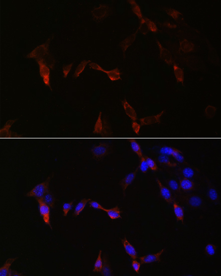 PLA2G5 Polyclonal Antibody (E-AB-66911)
