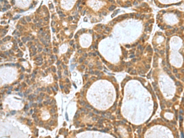 KANSL1L Polyclonal Antibody (E-AB-19093)