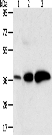 AKR1C1 Polyclonal Antibody (E-AB-12710)