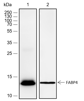 Recombinant FABP4 Monoclonal Antibody (AN301779L)