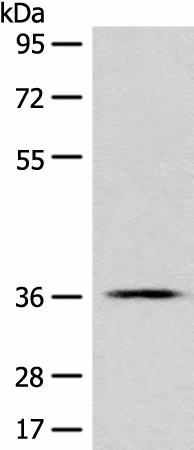 GPR55 Polyclonal Antibody (E-AB-19749)