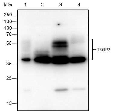 Recombinant TROP2 Monoclonal Antibody (AN301681L)