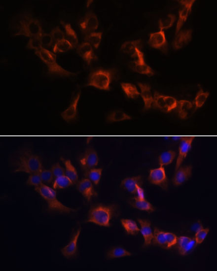 ARL13B Polyclonal Antibody (E-AB-67634)