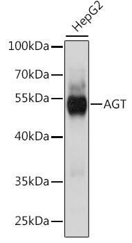 AGT Polyclonal Antibody (E-AB-66513)