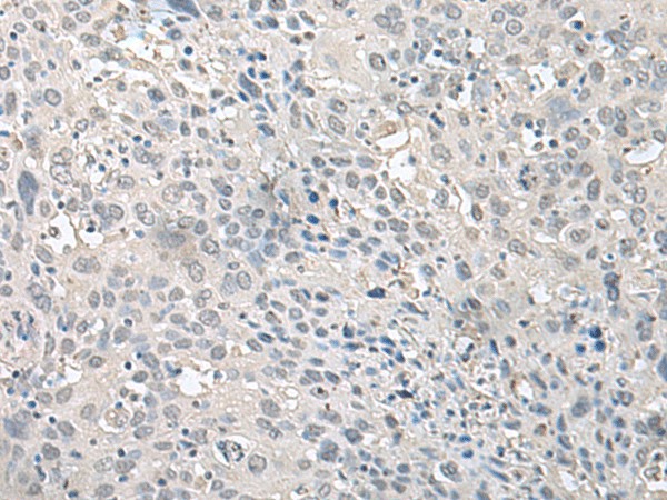 EPM2A Polyclonal Antibody (E-AB-52671)