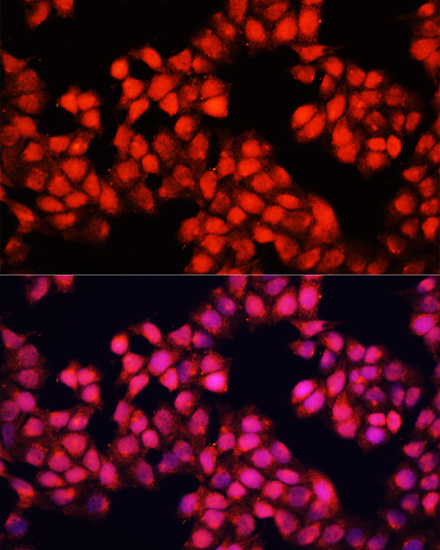 ALAD Polyclonal Antibody (E-AB-64148)