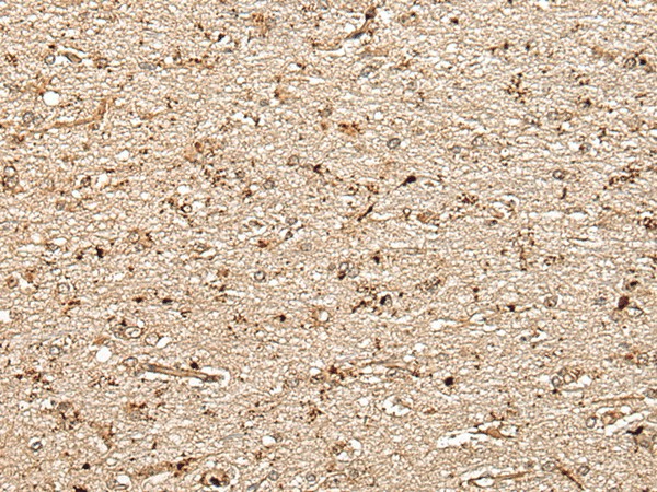 MCPH1 Polyclonal Antibody (E-AB-52481)