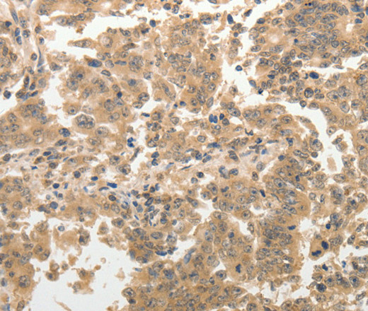 ADAR Polyclonal Antibody (E-AB-12696)