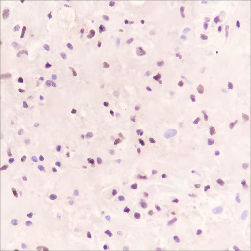 Recombinant SOX11 Monoclonal Antibody (AN301661L)