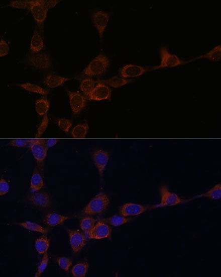 PIK3R4 Polyclonal Antibody (E-AB-66597)