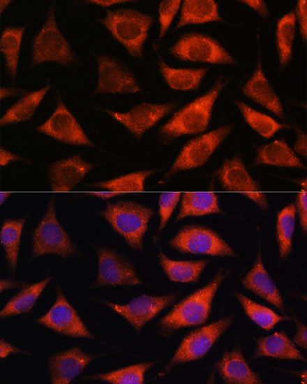 TMX2 Polyclonal Antibody (E-AB-67062)